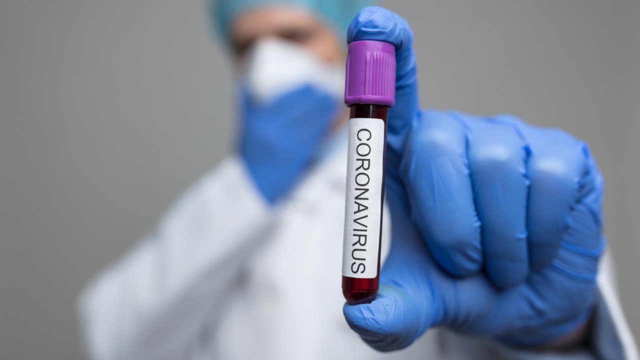 Śmierć kolejnego pacjenta z COVID-19 - kolejne przypadki zakażenia koronawirusem